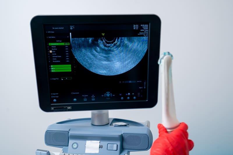Ultrasonido ginecológico transvaginal 3D en Jalisco, México